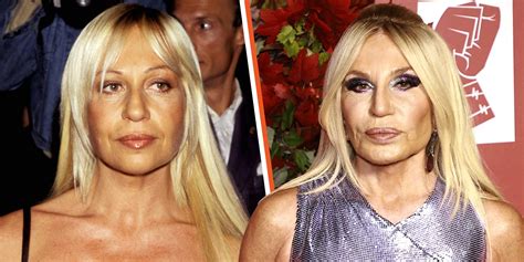 donatella versace chirurgia estetica|donatella versace before surgery.